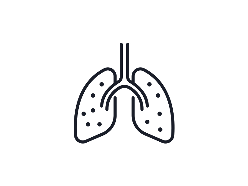 Lung and thoracic cancer